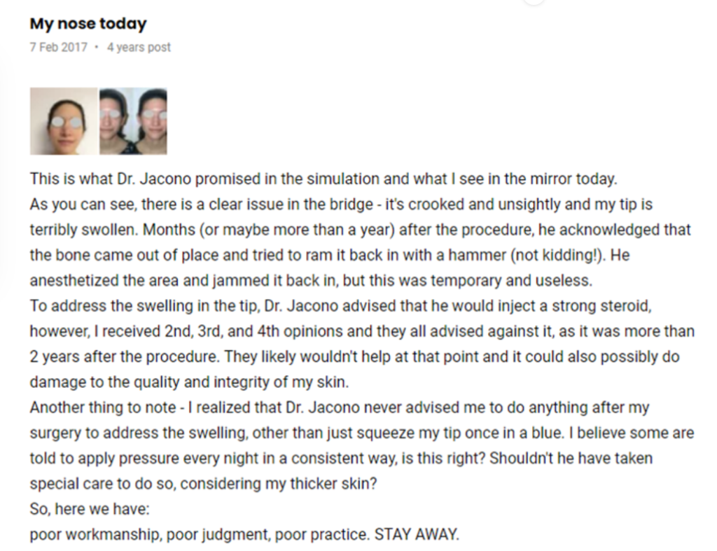 The "Hammer Incident": Dr. Andrew Jacono's Shocking Mishandling of a Surgery